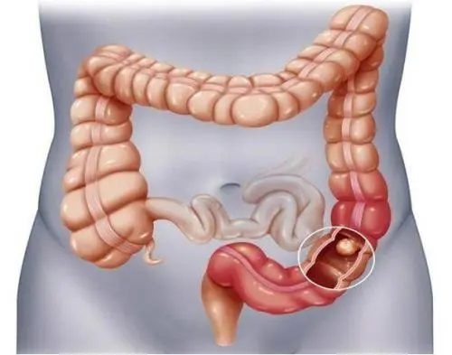 肠子图片1.jpg