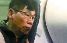 美联航拖下机医生被传获赔10亿 网友:也想挨打